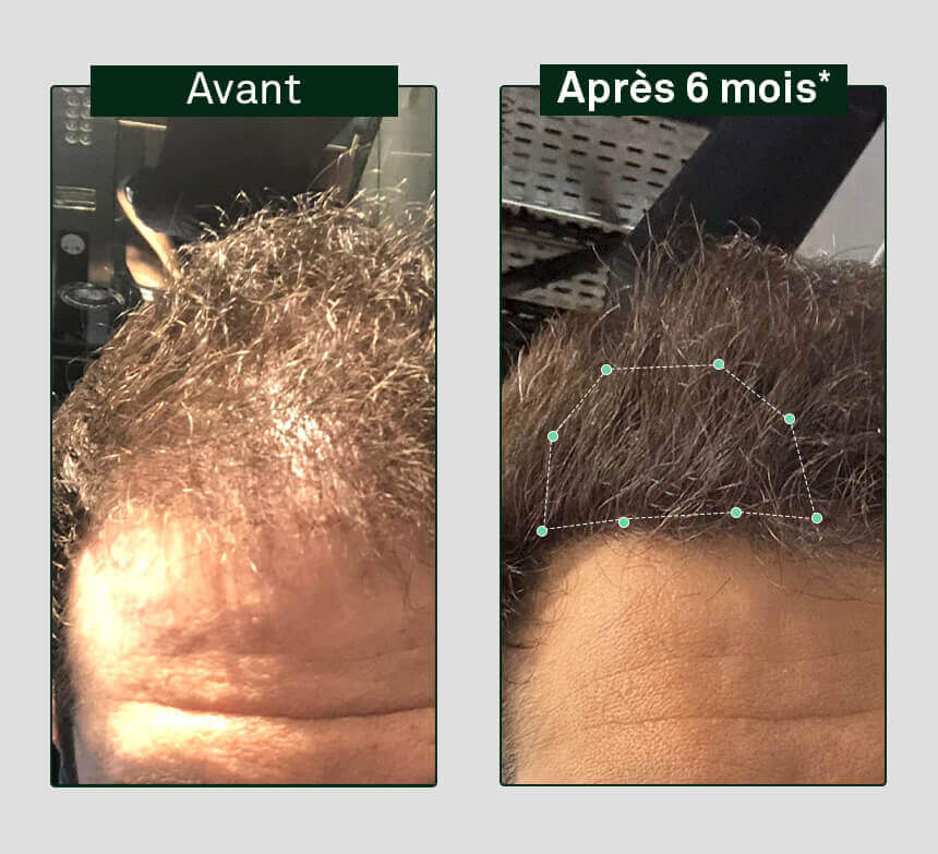 shampoo-growth